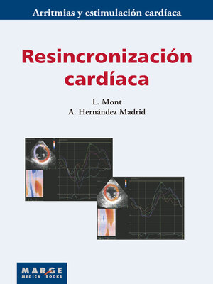 cover image of Resincronización cardíaca